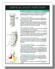 Cervical C01 Injection