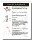 Cervical Selective Root Nerve Block