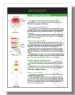Discography for diagnosing disc pain