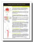 Lumbar Interlaminar Epidural Steroid Injection...