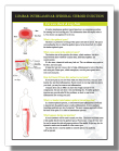 Lumbar Selective Nerve Root Block