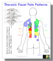 Thoracic Facet Pain Patterns