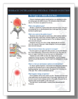 Thoracic ESI