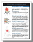 Thoracic ESI