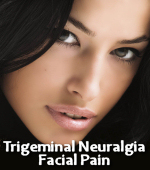 Trigeminal Neuralgia